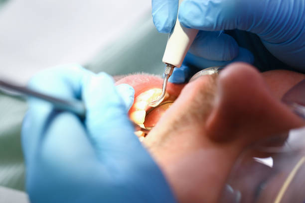 Best Urgent Care for Lost Fillings or Crowns in Hydro, OK