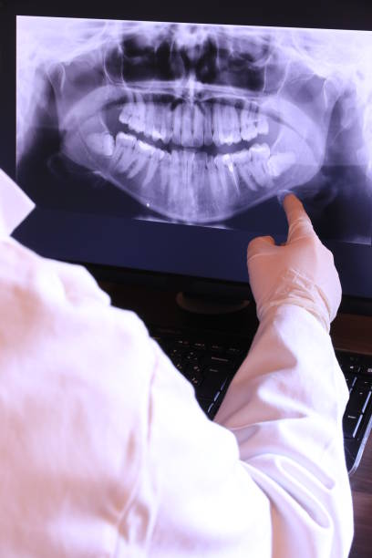 Best Emergency Treatment for Dental Infections or Abscesses in Hydro, OK