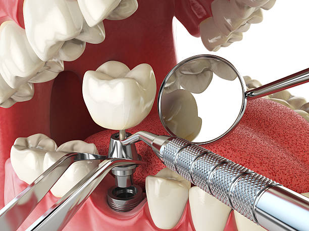 Best Emergency Root Canal Treatment in Hydro, OK